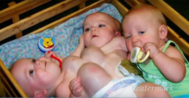 ყველაზე უჩვეულო ტყუპები მსოფლიოში, რომლებმაც მედიკოსები შოკში ჩააგდეს!