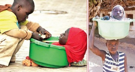 ძალიან მძიმე ისტორია გოგონაზე, რომელმაც 6 თვის ასაკიდან ზრდა შეწყვიტა ! ძალიან მძიმე ისტორია გოგონაზე, რომელმაც 6 თვის ასაკიდან ზრდა შეწყვიტა !