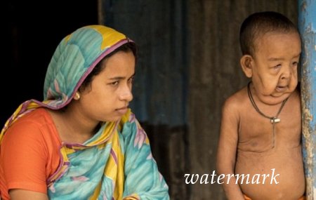 ოთხი წლის ბავში, რომელიც 80 წლის მოხუცს გავს ოთხი წლის ბავში, რომელიც 80 წლის მოხუცს გავს