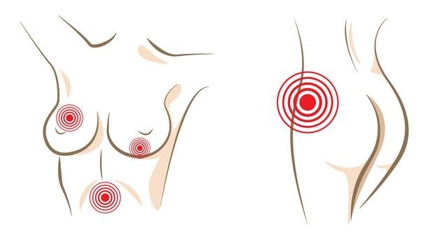 ვაგინალური პრობლემების 8 ნიშანი