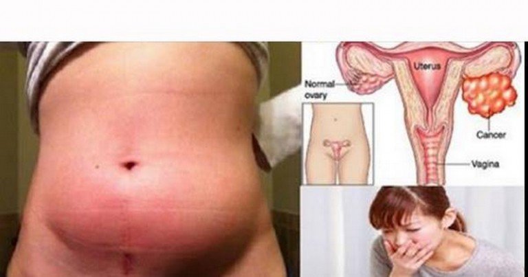 ფრთხილად! 10 ნიშანი, რომელიც არცერთმა ქალმა არ უნდა დააიგნოროს!