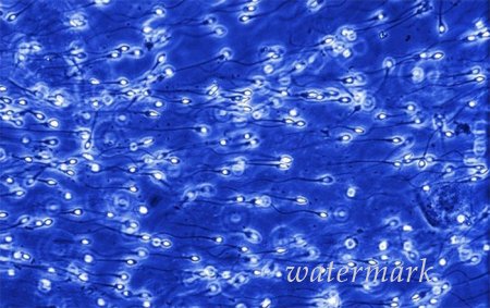 ჩასახვიდან ბავშის დაბადებამდე: 9 თვის განმავლობაში ორგანიზმში მომხდარი ცვლილებები (19 ფოტო) ჩასახვიდან ბავშის დაბადებამდე: 9 თვის განმავლობაში ორგანიზმში მომხდარი ცვლილებები (19 ფოტო)