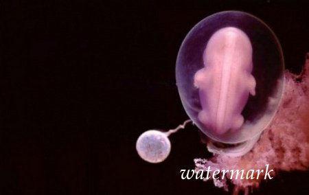 ჩასახვიდან ბავშის დაბადებამდე: 9 თვის განმავლობაში ორგანიზმში მომხდარი ცვლილებები (19 ფოტო) ჩასახვიდან ბავშის დაბადებამდე: 9 თვის განმავლობაში ორგანიზმში მომხდარი ცვლილებები (19 ფოტო)