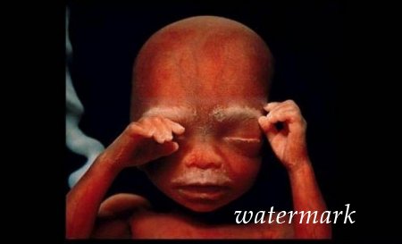 ჩასახვიდან ბავშის დაბადებამდე: 9 თვის განმავლობაში ორგანიზმში მომხდარი ცვლილებები (19 ფოტო) ჩასახვიდან ბავშის დაბადებამდე: 9 თვის განმავლობაში ორგანიზმში მომხდარი ცვლილებები (19 ფოტო)