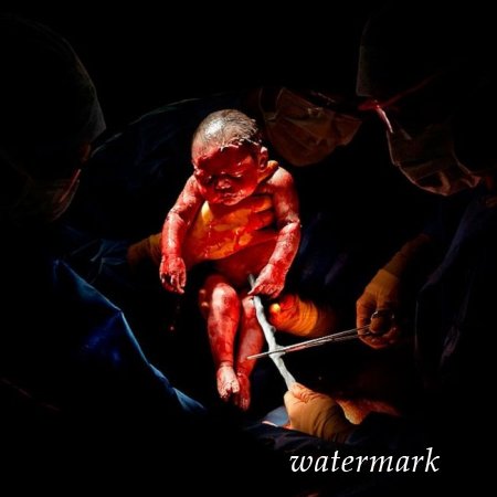 9 დაუჯერებლად ინტიმური კადრი, დაბადებიდან პირველივე წამებზე ... 9 დაუჯერებლად ინტიმური კადრი, დაბადებიდან პირველივე წამებზე ...