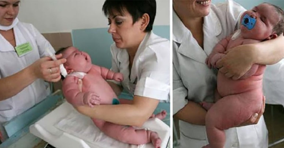 272 კილოგრამიანი ქალის ახალშობილი