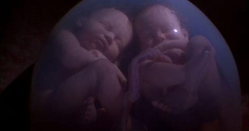 აი, რა დაინახა დედამ ექოსკოპიის კაბინეტში. რასაც ტყუპები მუცელში აკეთებდნენ ეს