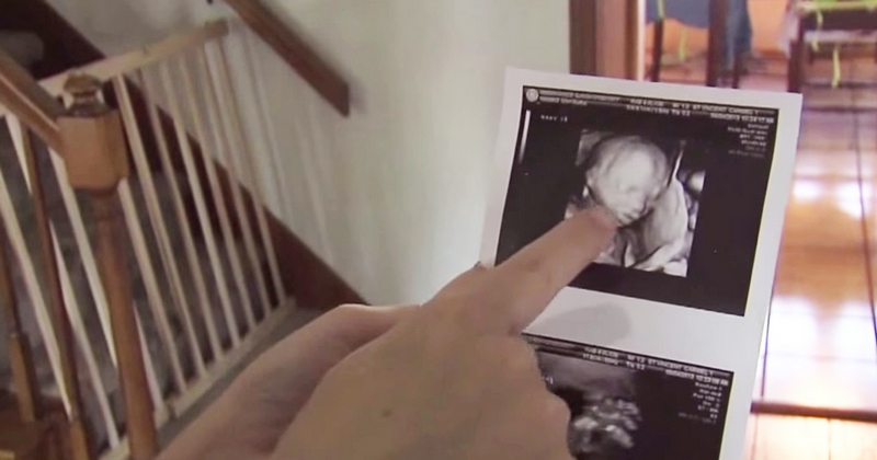 აი, რა დაემართა დედას სამი ტყუპის გაჩენის შემდეგ. ამას ცოლ-ქმარი აღარ მოელოდა