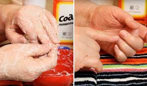 გაუხეშებულ და დახეთქილ ხელების კანს ამ რეცეპტით უშველით